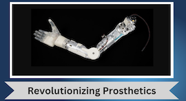 Xray of prosthetic arm