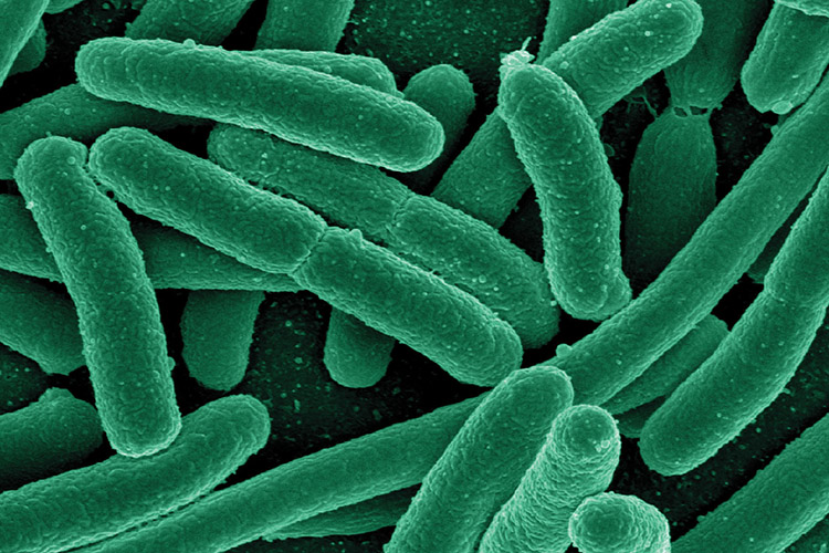 Opens larger image for Case Report: Complicated Urinary Tract Infection Due to an Extensively Resistant Escherichia coli in a Returning Traveler